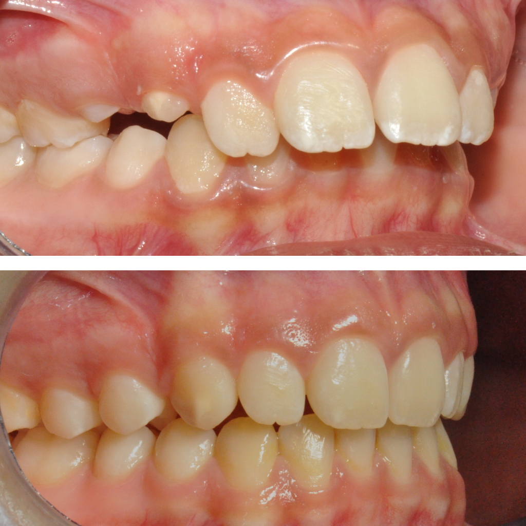 trattamenti - prima & dopo