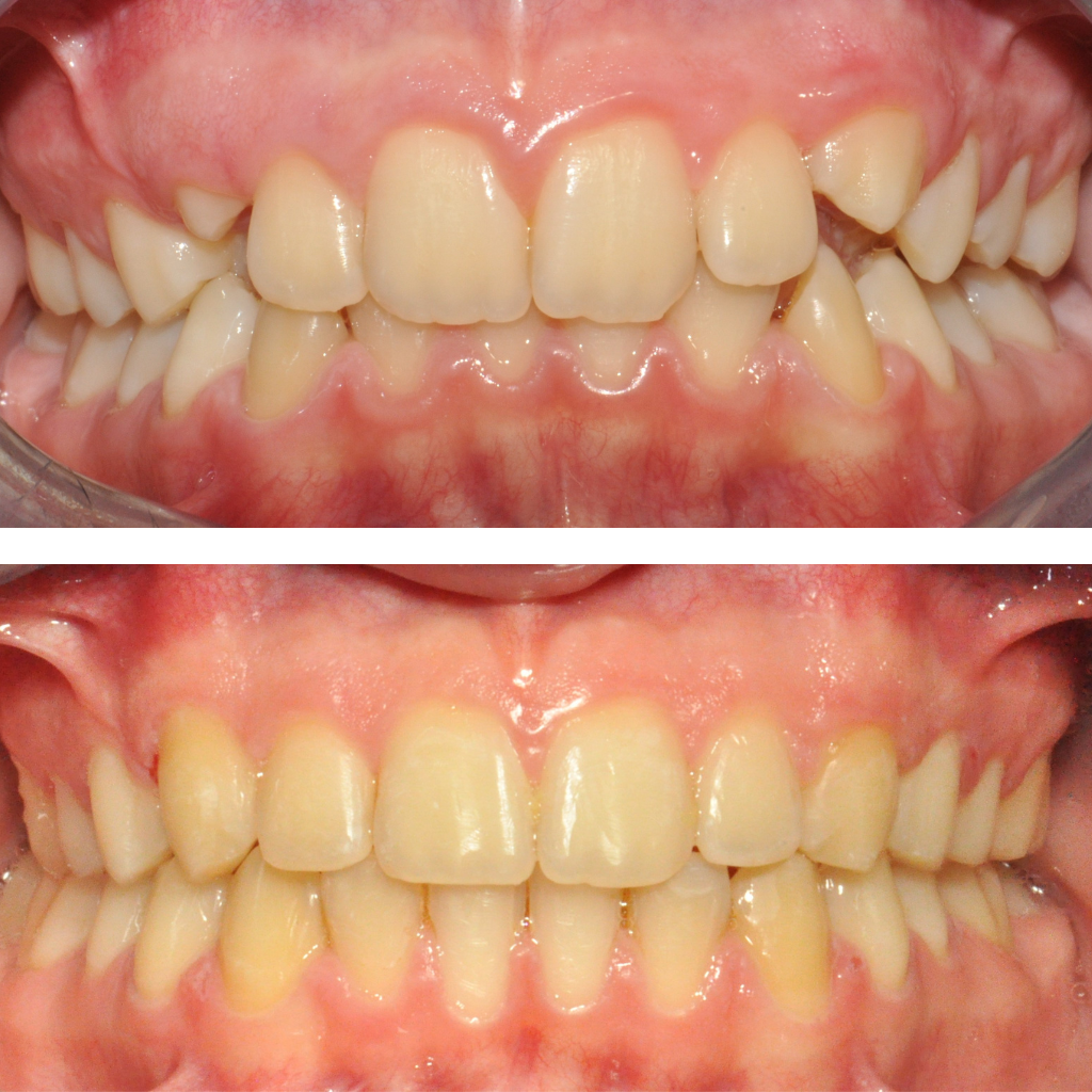trattamenti - prima & dopo