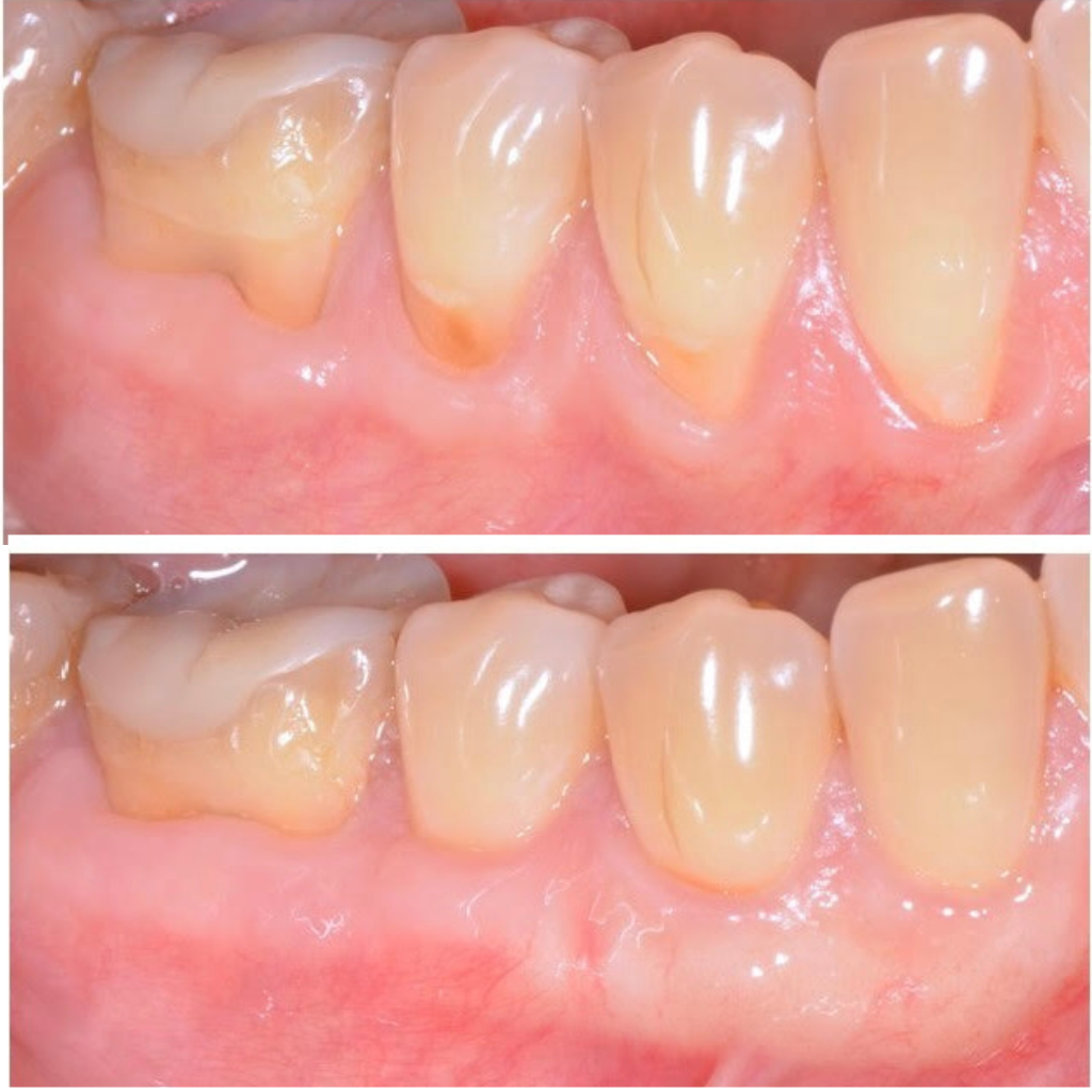 trattamenti - prima & dopo